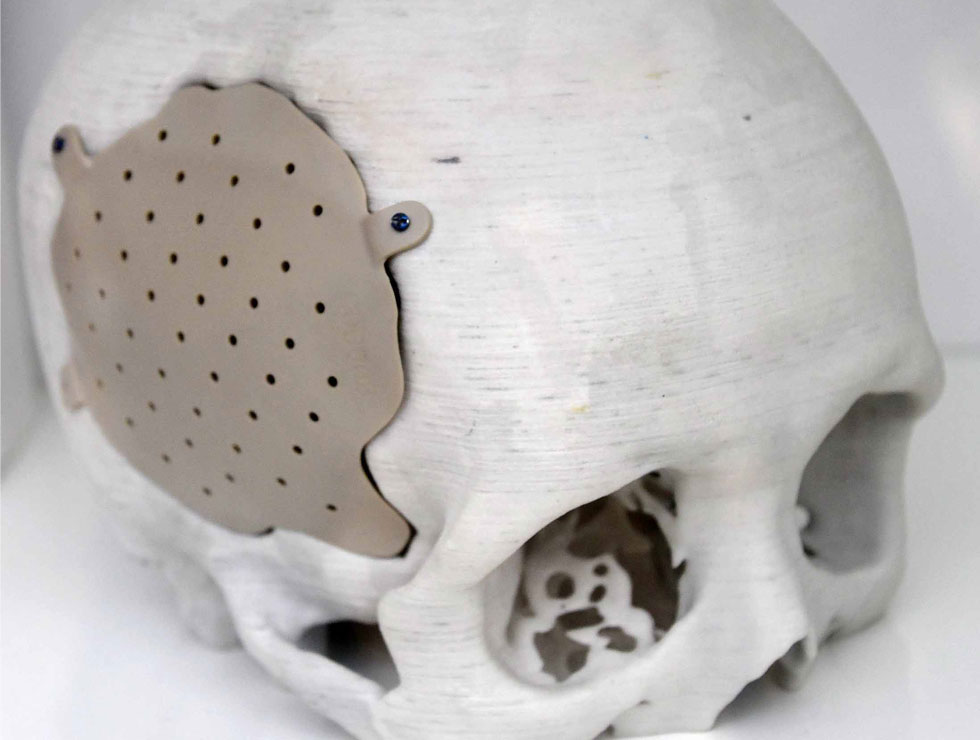 �@������ɫ�ĸ�ˎ��������Ŀ��������3D��ӡ���XĤ��